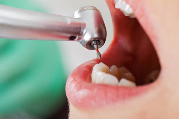 Best Emergency Treatment for Dental Infections or Abscesses in Watertown, MN